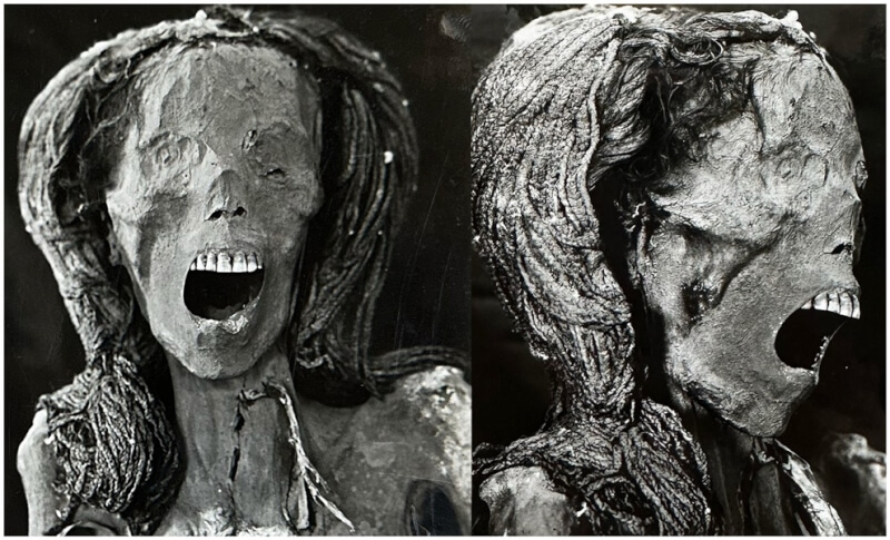 科學家研究一具1935年出土的古埃及女性木乃伊，推測她可能是在極度痛苦下離世。（圖取自Frontiers網頁frontiersin.org）