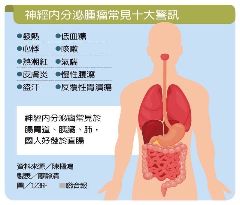 神經內分泌腫瘤常見十大警訊 製表╱廖靜清